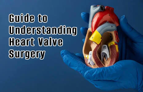 Understanding Heart Valve Surgery