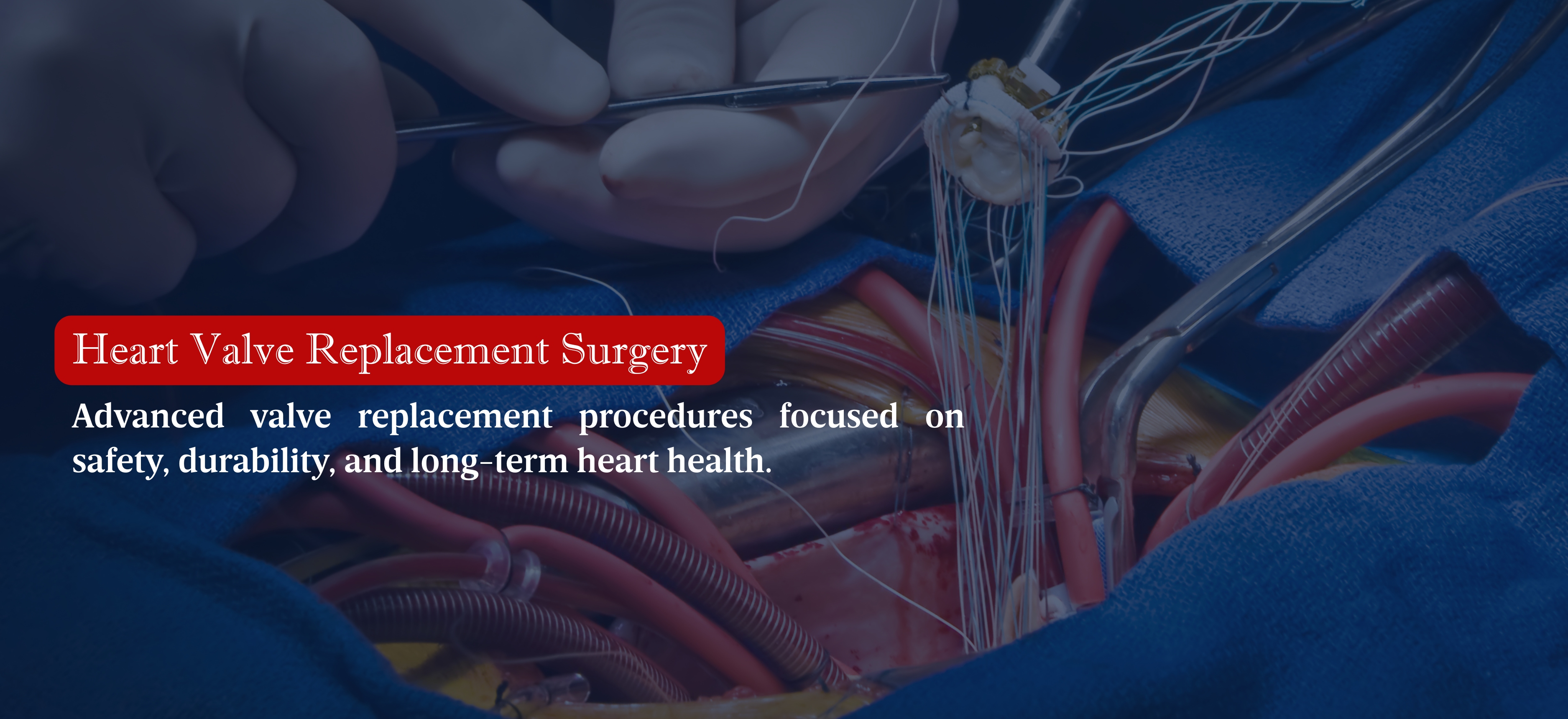 Heart Valve Replacement Surgery